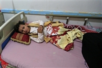 "الصحة العالمية" تؤكد ارتفاع حالات الإصابة بالحصبة في اليمن خلال العام الماضي 