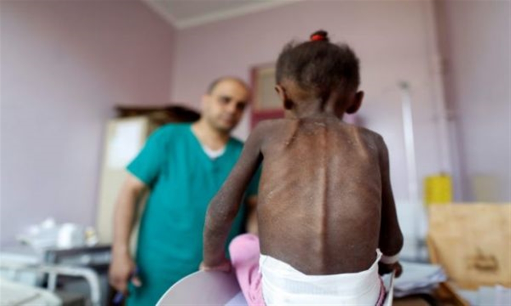 14 مليون شخص على حافة المجاعة في اليمن
