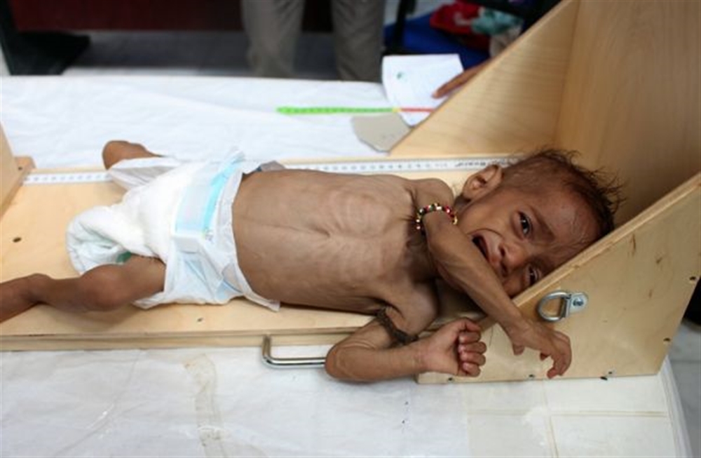 الصحة العالمية: 11 مليون طفل يمني بحاجة لمساعدة إنسانية