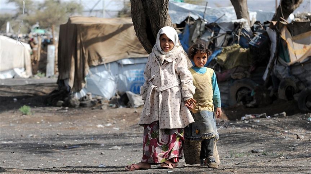 وفاة 85 ألف طفل يمني بسبب سوء التغذية