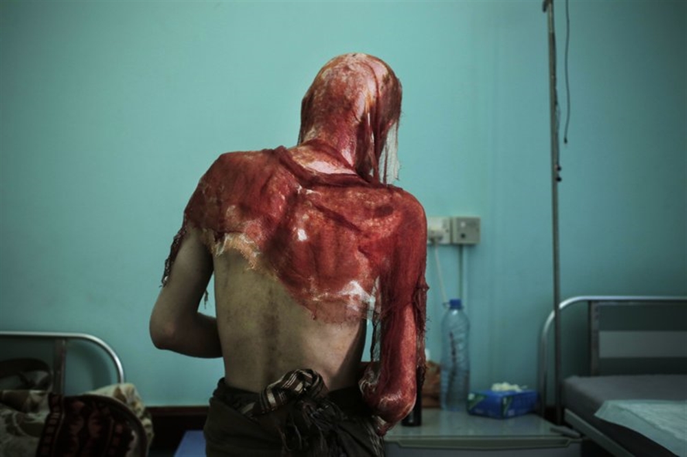 "أسوشيتد برس" تكشف عن عمليات تعذيب مروعة ليمنيين في سجون الحوثيين