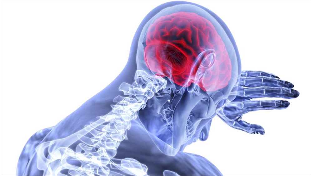 9 أعراض تنذر بسرطان الدماغ