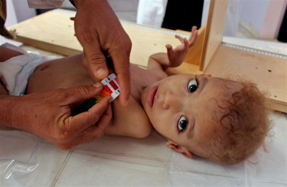 هيئة إنقاذ الطفولة: وفاة 100 ألف طفل يمني جراء الجوع الشديد