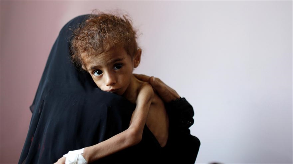اليونسيف: وفاة أمّ وستة مواليد كل ساعتين في اليمن