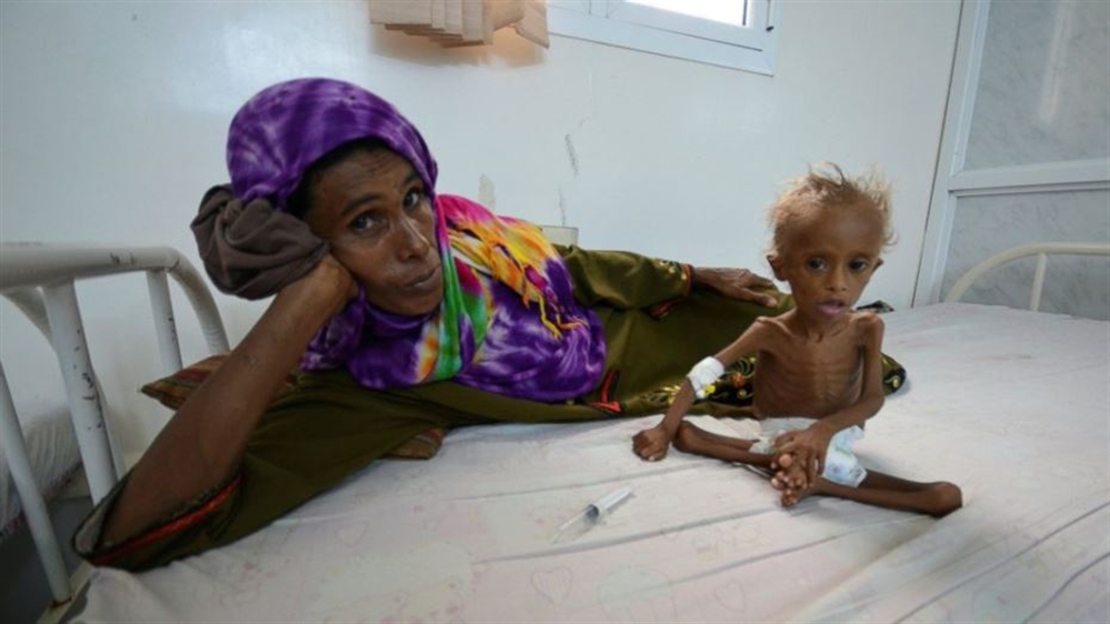 منظمة دولية: 3.2 مليون طفل وامرأة في اليمن يعانون من سوء التغذية الحاد