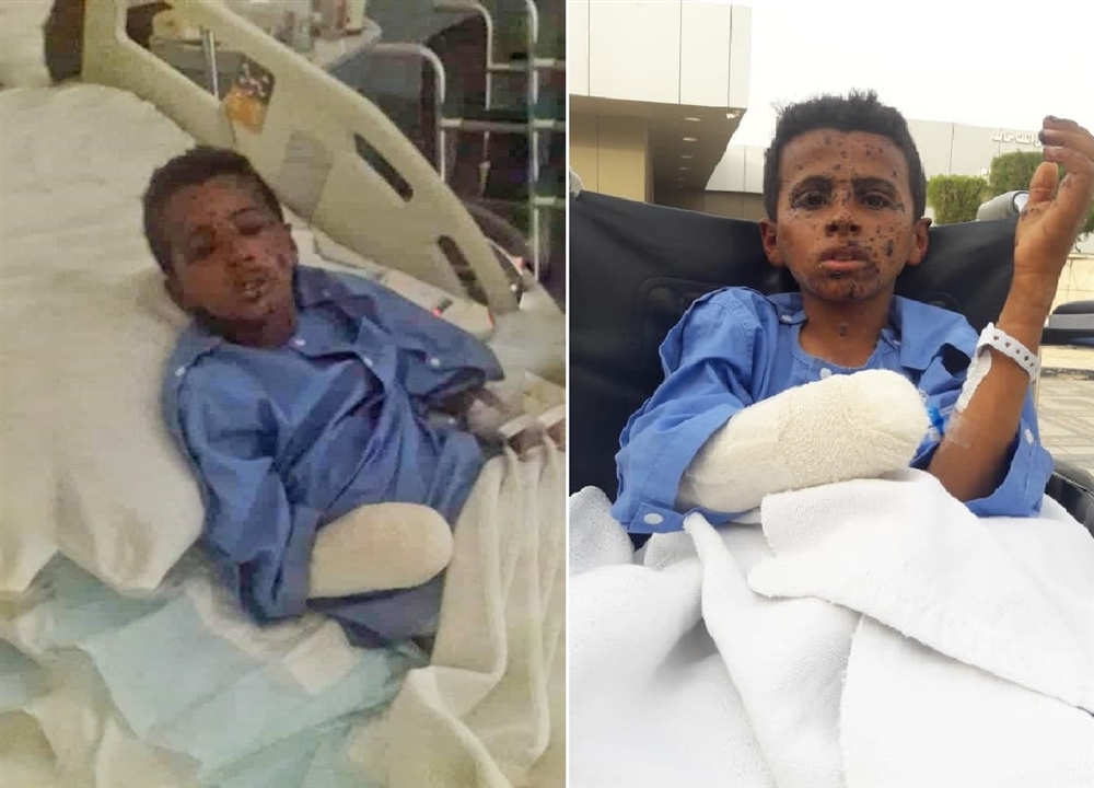 إصابة 3 أطفال بانفجار لغم أرضي في "اليتمة" بمحافظة الجوف