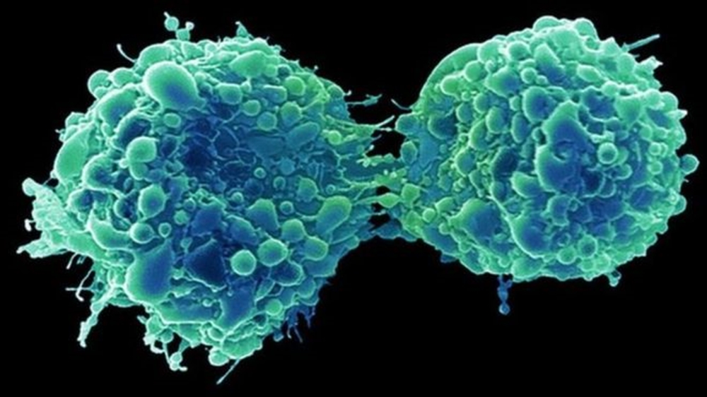 فيروس زكام شائع "يكافح سرطان المثانة"