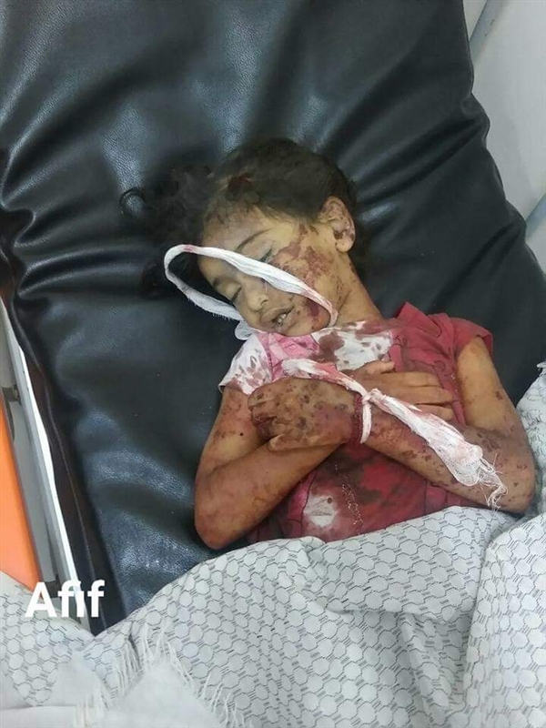 مقتل طفلتان وإصابة والدتهن بجروح بليغة في قصف حوثي على تعز