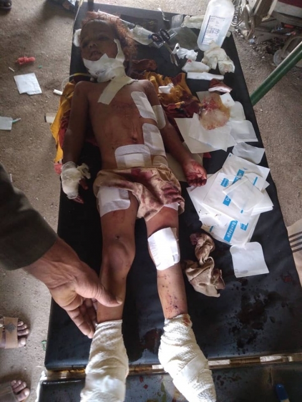 مقتل طفلة بانفجار عبوة ناسفة زرعها الحوثيون بالبيضاء