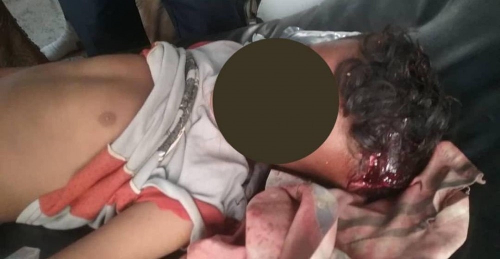 الحديدة: مقتل طفل برصاص قناص حوثي بحيس