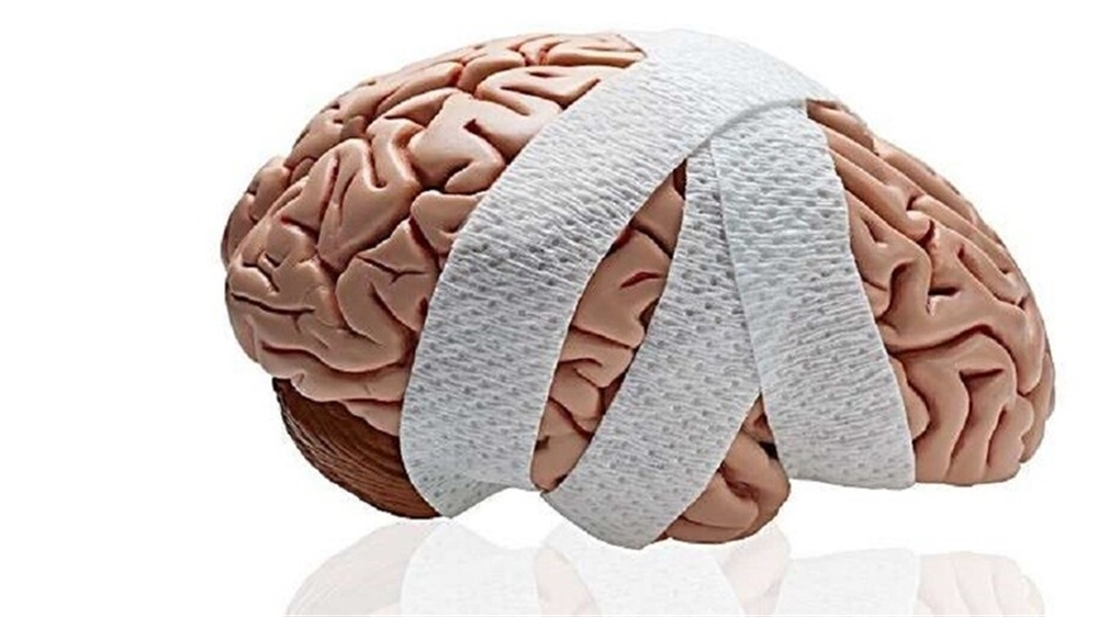 علماء: إصابة واحدة بالرأس يمكن أن تؤدي إلى الخرف