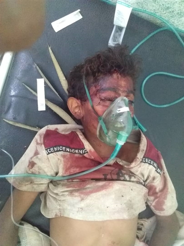 مليشيا الحوثي ترتكب مجزرتين في التحيتا وحيس وسقوط 13 قتيل وجريح من أسرة واحدة