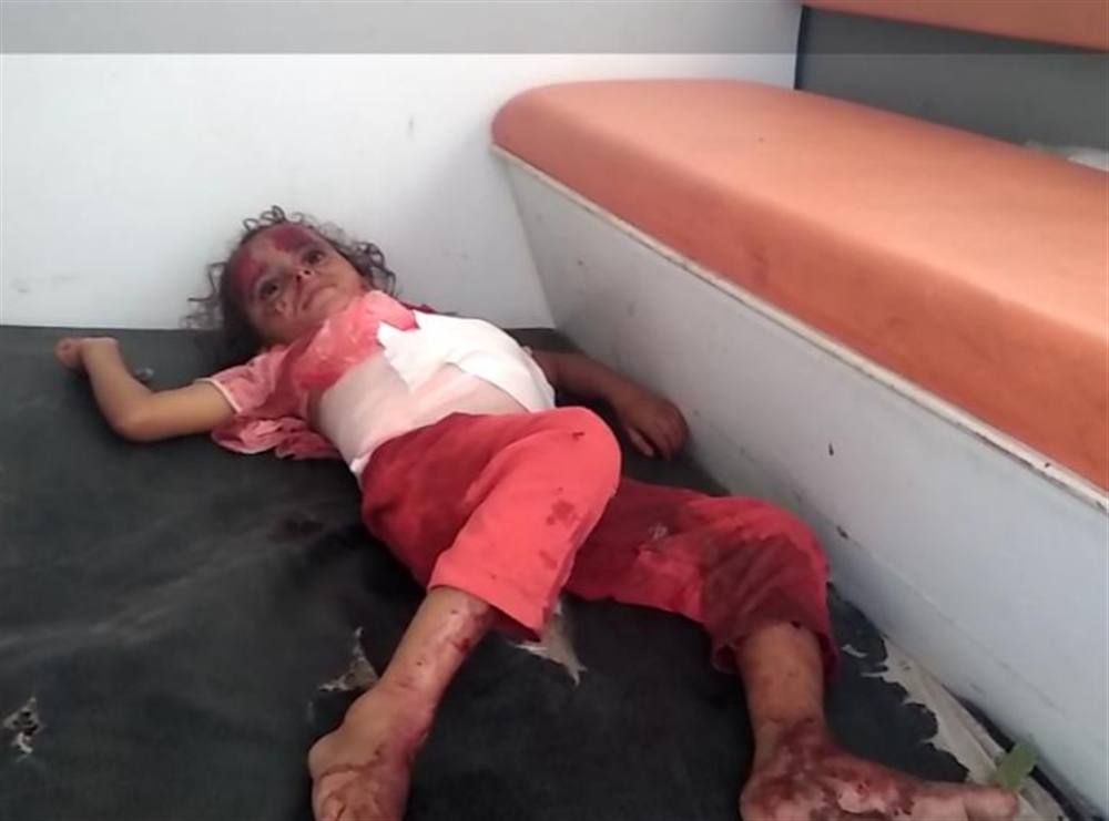 إصابة طفلين جراء قصف مليشيا الحوثي على الاحياء السكنية جنوبي الحديدة