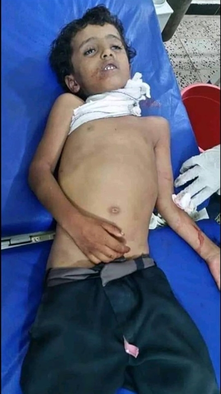 مقتل طفل بقذيفة حوثية شمالي الضالع