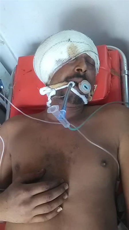 إصابة ضابط ارتباط بالفريق الحكومي بنيران الحوثيين في الحديدة