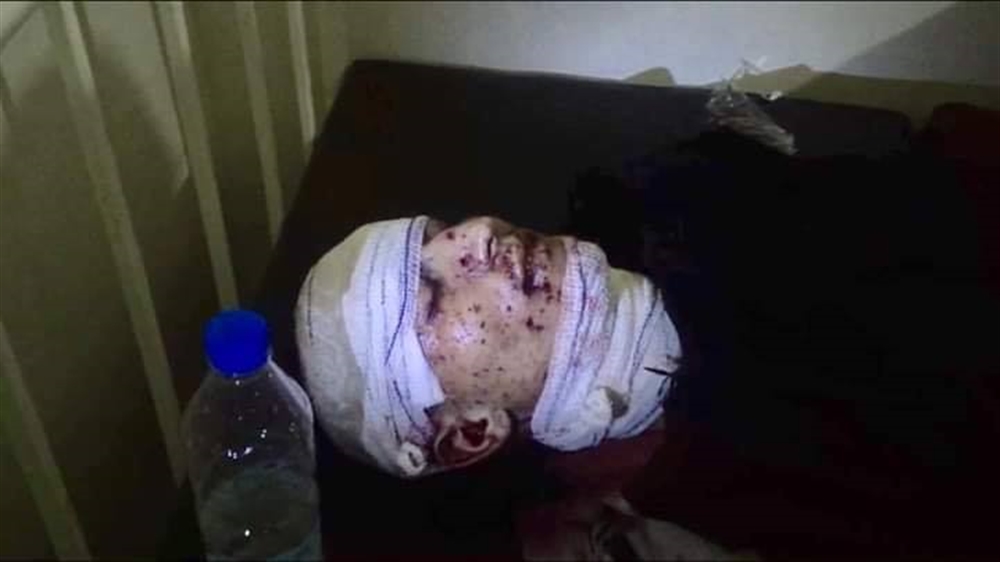 الضالع: مقتل شابين بانفجار عبوة ناسفة في قعطبة