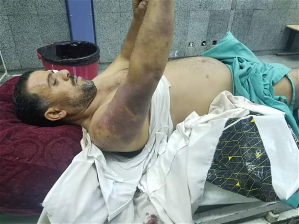 ريمة : مواطنون يتعرضون للتعذيب المفرط في سجن لمليشيا الحوثي