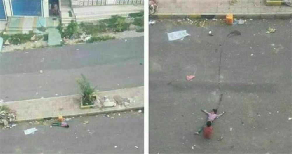 للتضليل .. ناشطون ايرانيون يتهمون قناص سعودي بإصابة طفلة الماء بتعز