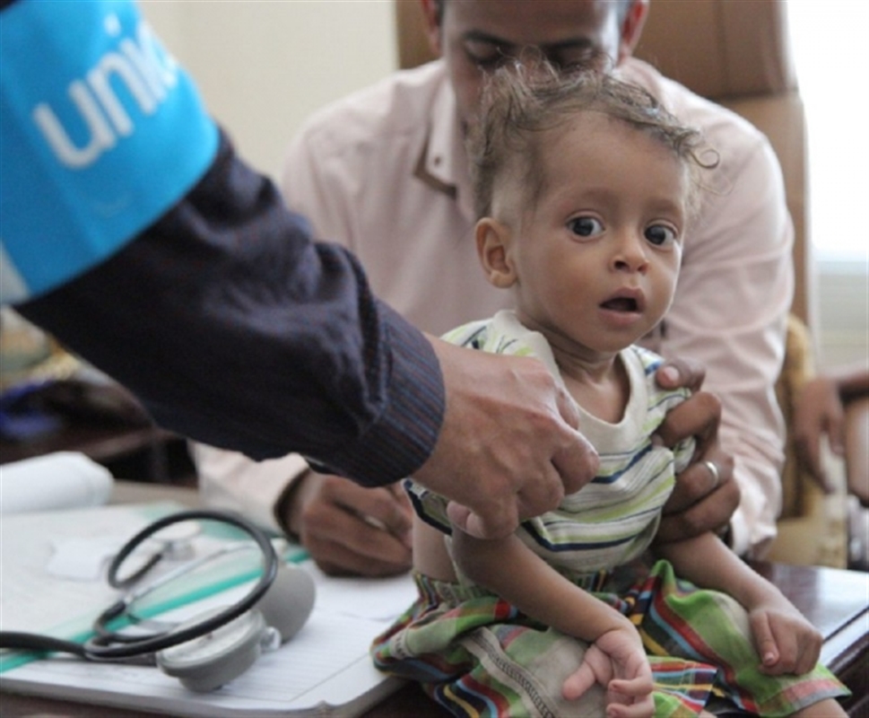 الصحة العالمية : أنشأنا 83 مركزا للتغذية العلاجية باليمن