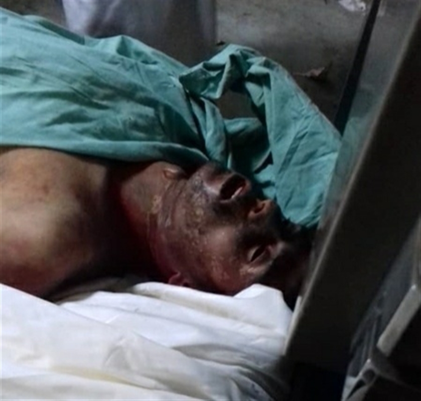 منظمة دولية تدين مقتل مواطن تحت التعذيب في سجون الحوثي
