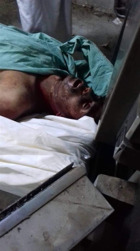 منظمة سام: مليشيا الحوثي تجبر مختطفا على الاتصال بأسرته لدفن شقيقه المتوفى تحت الاختطاف والتعذيب