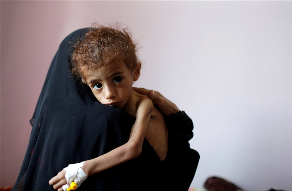 منظمة دولية: 100 ألف طفل دون سن الخامسة في اليمن على شفا المجاعة