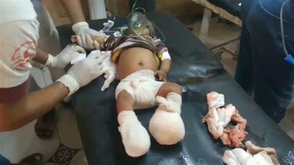 الحديدة.. ارتفاع حصيلة ضحايا المجزرة الحوثية وتصعيد جديد في بيت الفقيه
