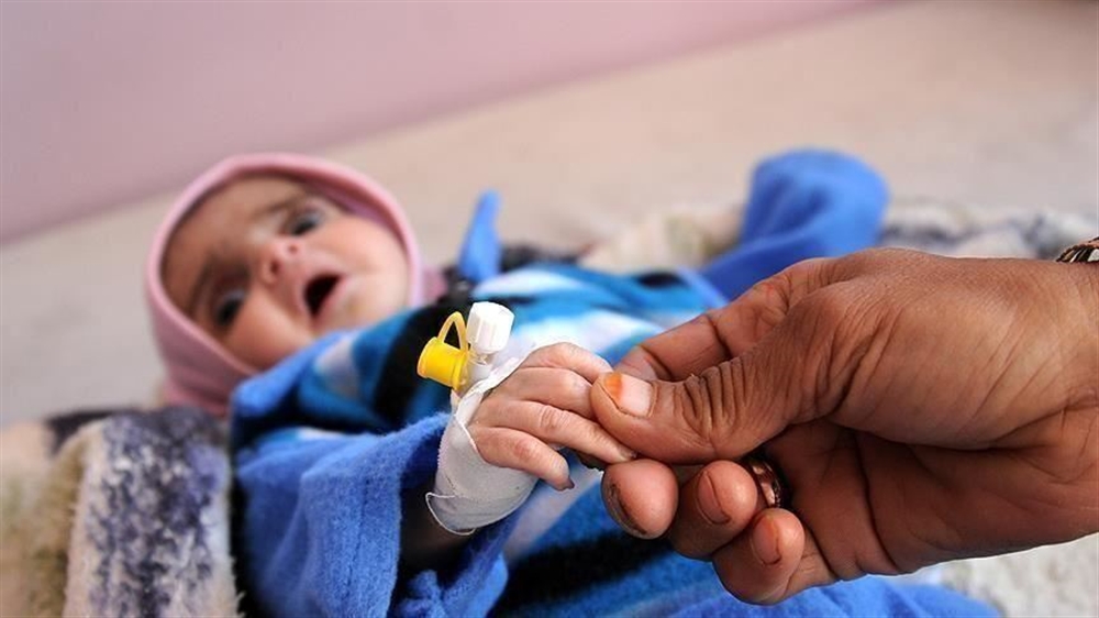 الصحة العالمية: 2.25 مليون طفل يمني يعانون من سوء التغذية الحاد
