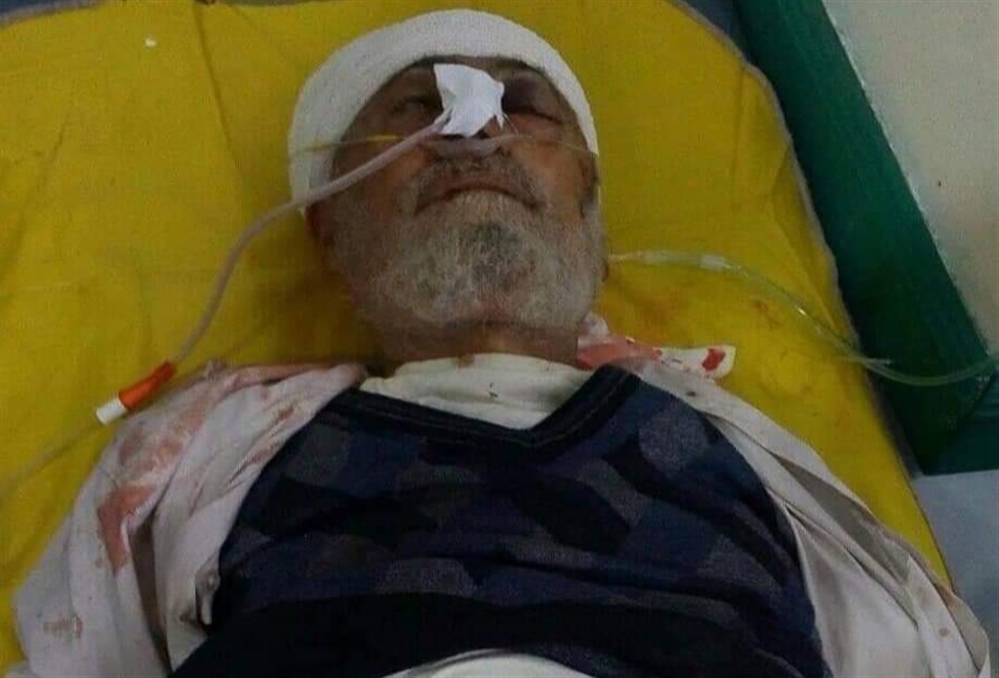 تعز.. وفاة مواطن "مسن" متأثرا بإصابته بطلقة قناص حوثي